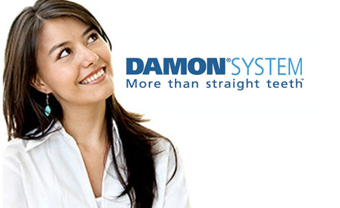 damon system